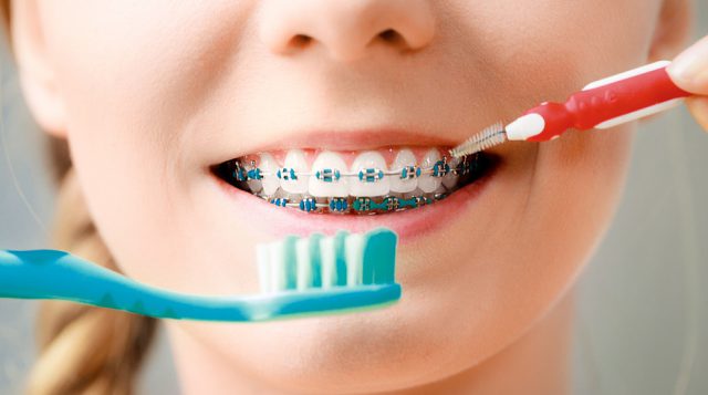 Oral gigiena