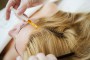 Топ 38 советов по проведению мезотерапии волос